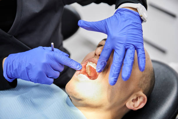 Best Knocked-Out Tooth Emergency  in Canal Fulton, OH