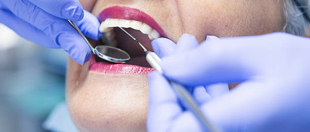 Best Broken Tooth Emergency  in Canal Fulton, OH