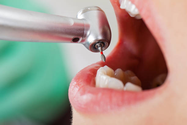 Best Emergency Tooth Extraction  in Canal Fulton, OH